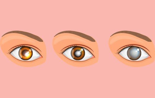 Understanding and Preventing Common Eye Diseases: Glaucoma and Diabetic Retinopathy